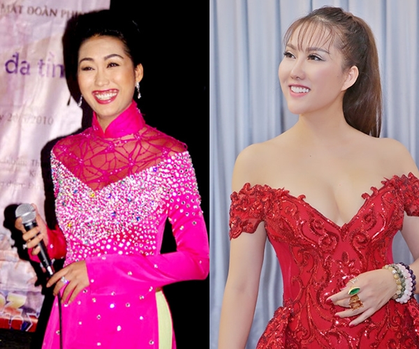 6 sao Việt công khai thừa nhận phẫu thuật thẩm mỹ trong năm 2017